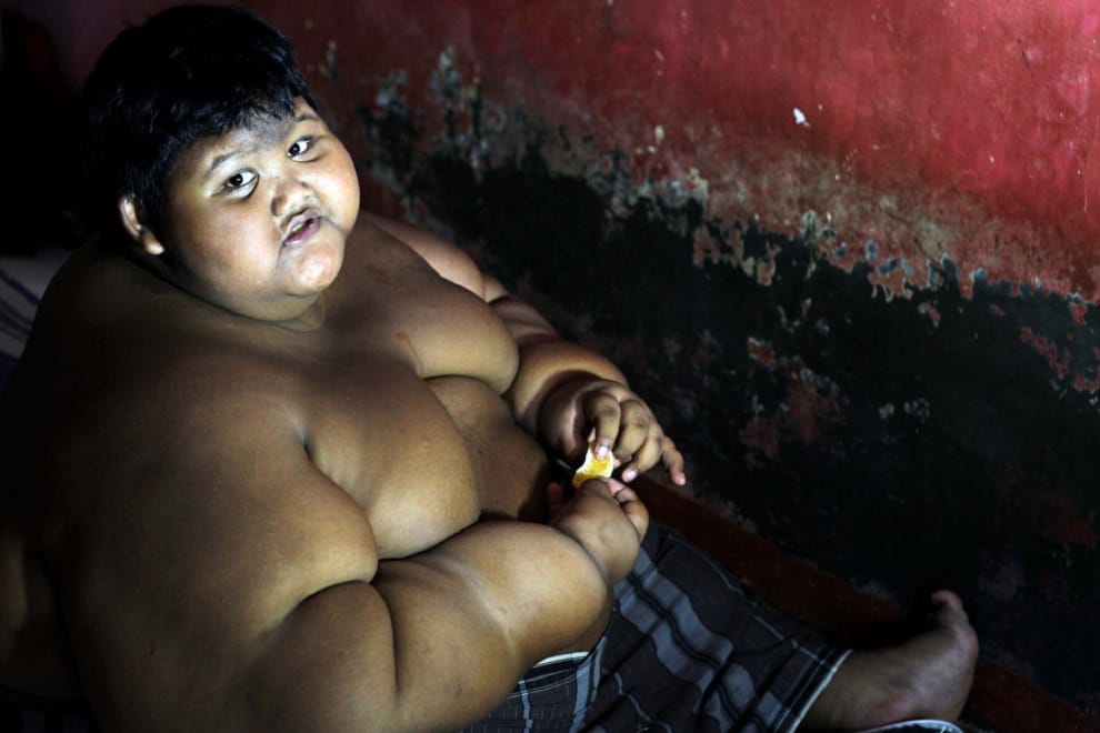 World’s heaviest 10-year-old boy