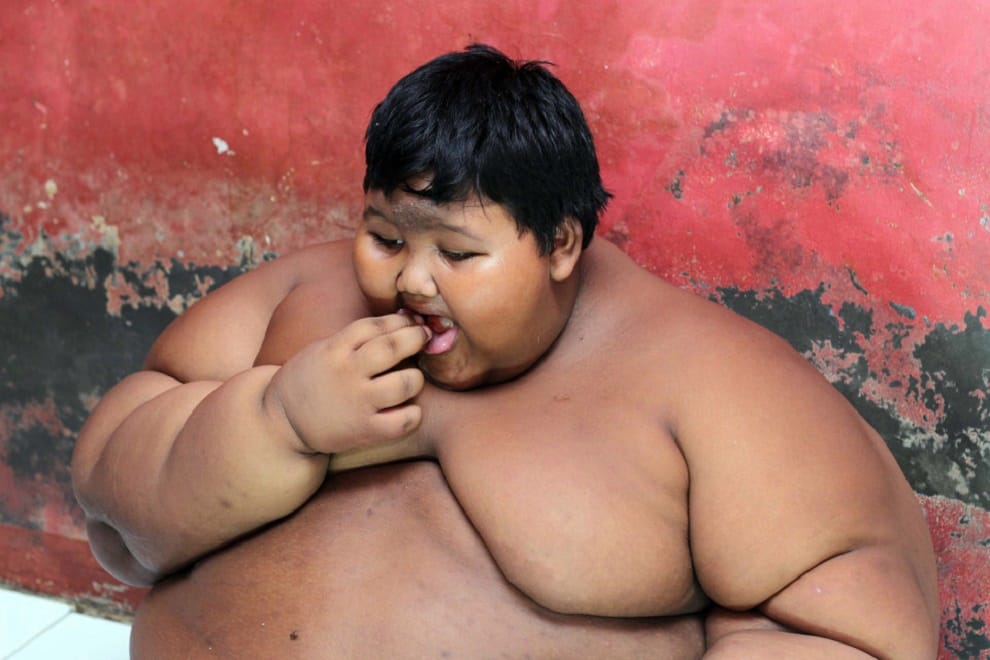 World’s heaviest 10-year-old boy