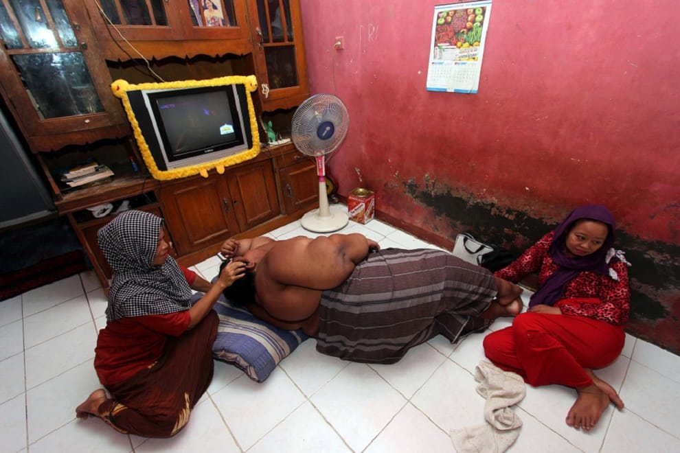 World’s heaviest 10-year-old boy