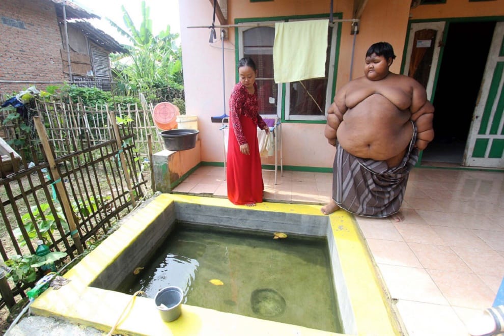 World’s heaviest 10-year-old boy