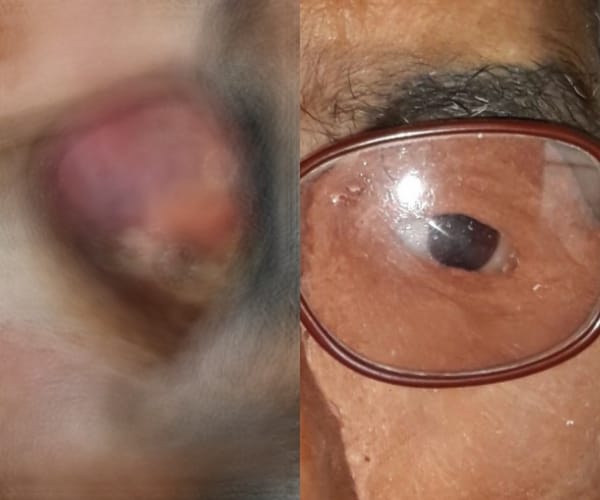KGMU doctors give a new face to a patient.