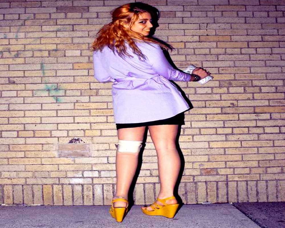 Woman Cut Off Her Leg To Wear High Heels