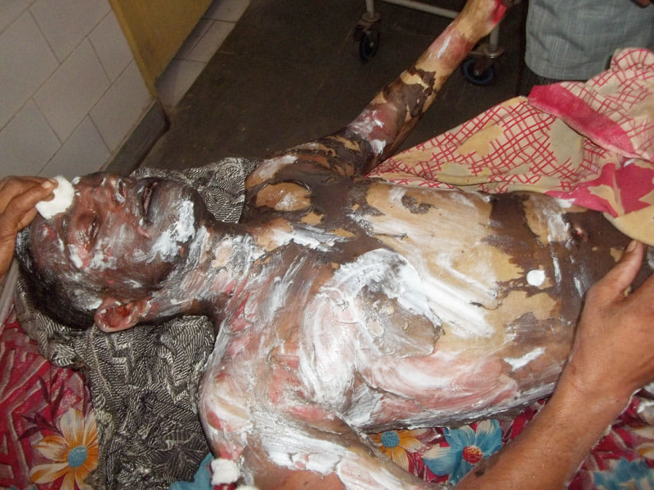 The farmer did not yield the self-immolation