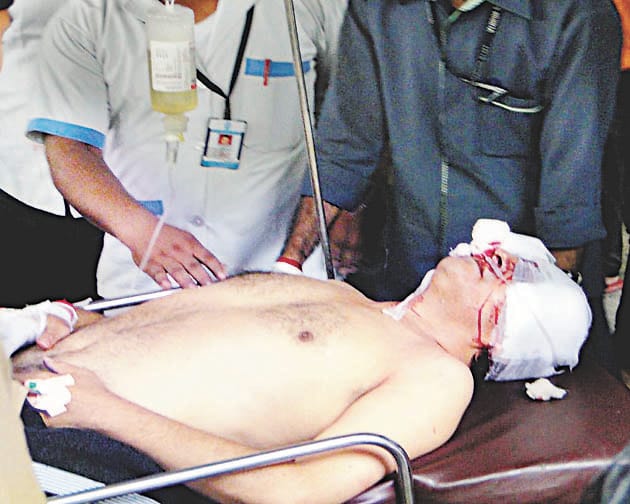 SP leader's brother shot himself, serious