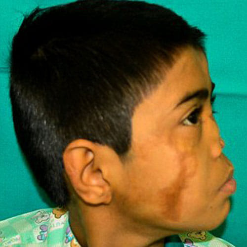 this boy has nose on his forehead
