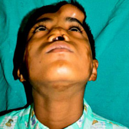 this boy has nose on his forehead