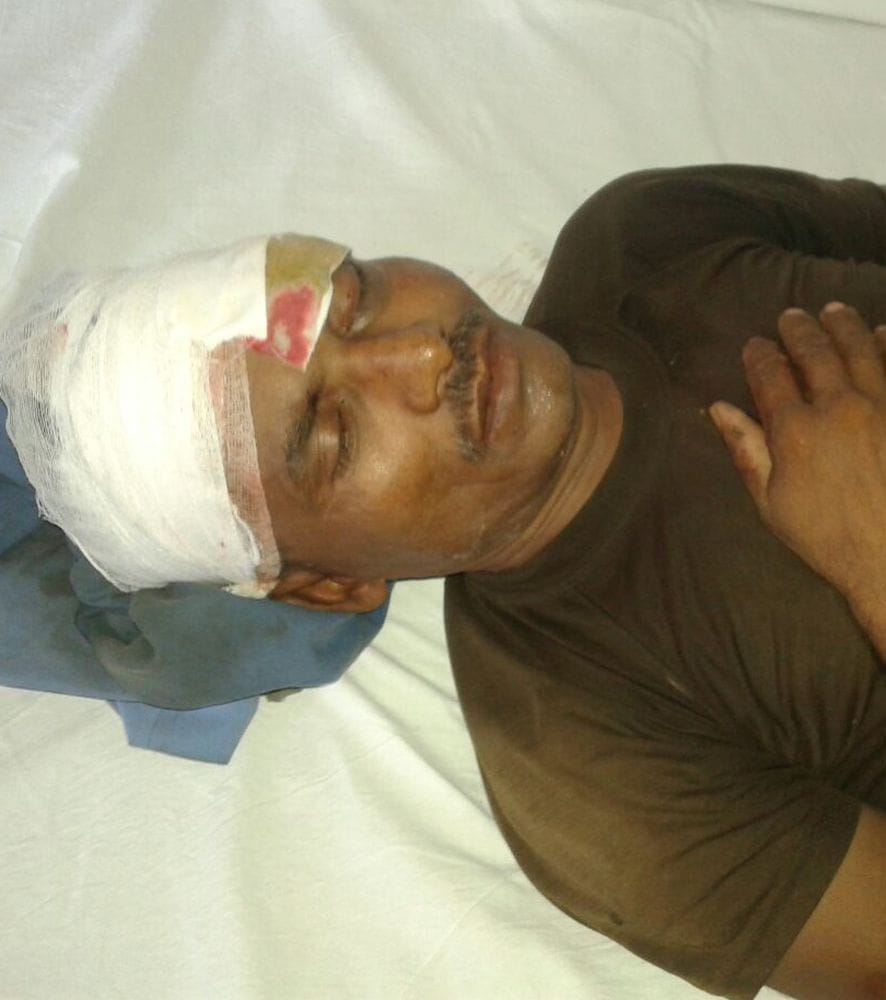 Four injured in the accident, hospitalized