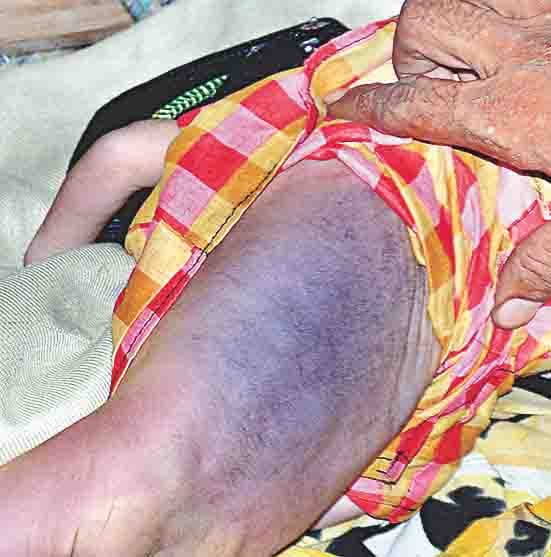 untrained woman,health,accident
