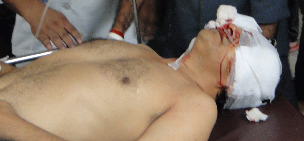 samajwadi party leader brother shoots himself