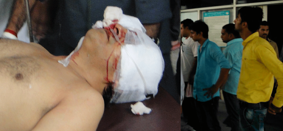 samajwadi party leader brother shoots himself