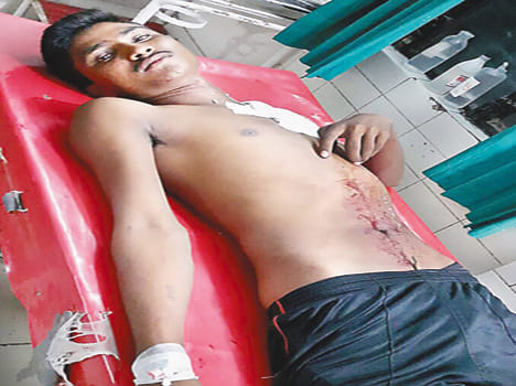 loader driver was shot,wounded