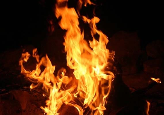  burnt themselves for Bangles 