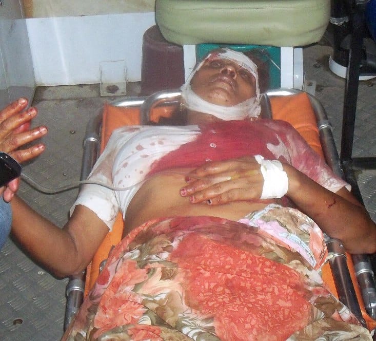 Wife was injured in infighting knockout