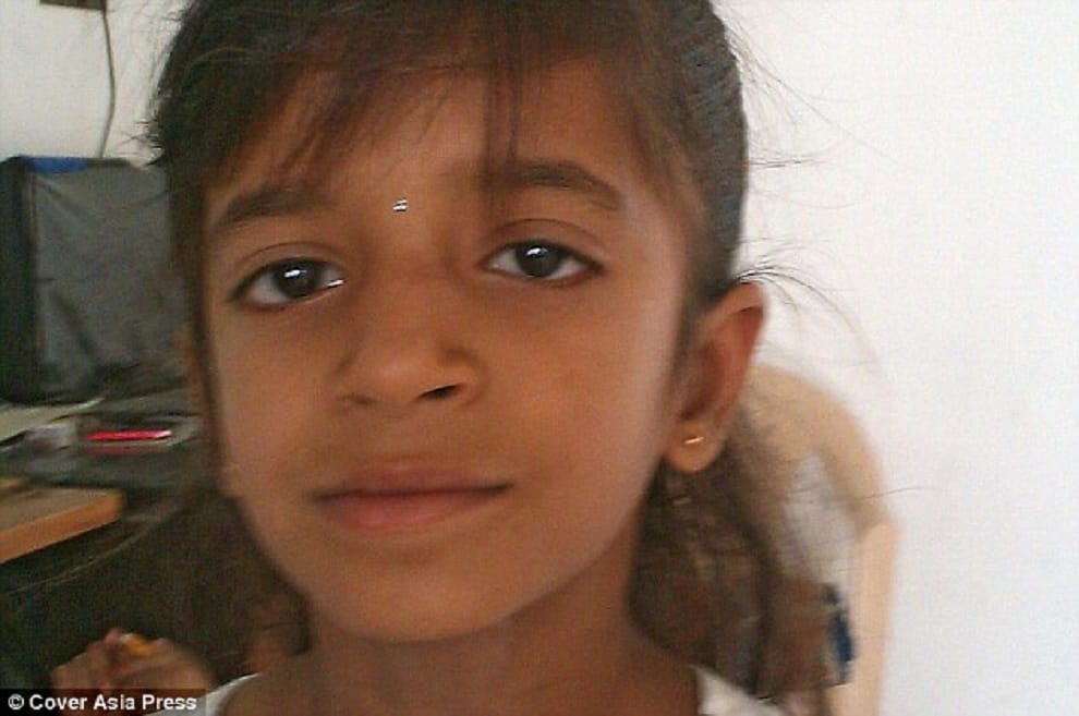 Indian girl who had more than a thousand ants 