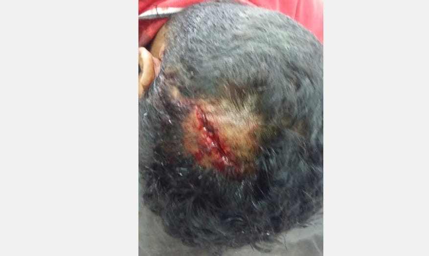 Roit in HP University, Clash between ABVP and SFI.