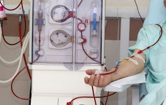 Patients will not have to wait for dialysis, it will be expanded to 14 units