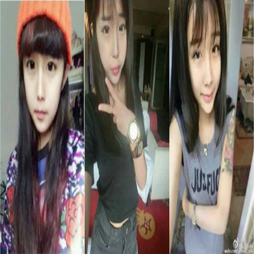 girlfriend underwent plastic surgery to win her boyfriend back
