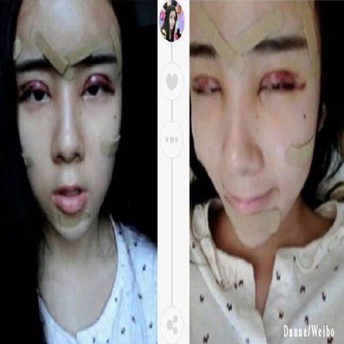 girlfriend underwent plastic surgery to win her boyfriend back
