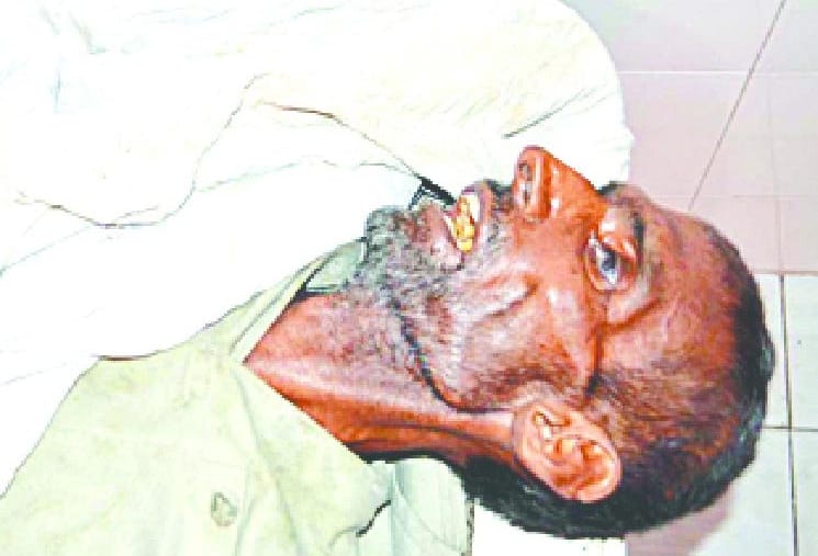 the injured died in CHC by Negligence 