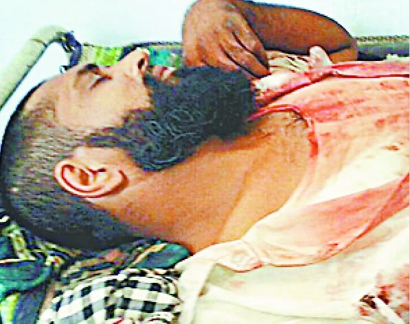tigar attaked, two hurted