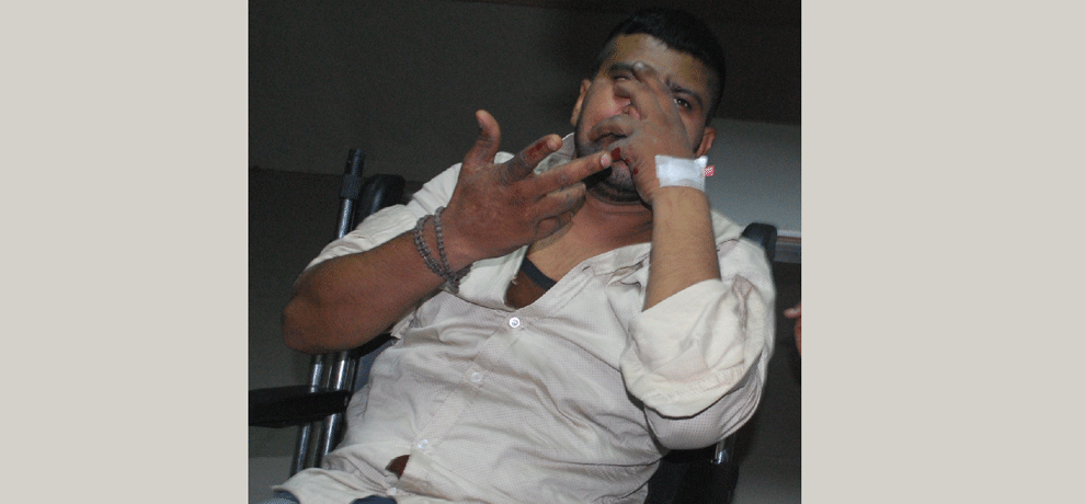 Revealing miscreants, Ghaziabad jewelers were selling swag