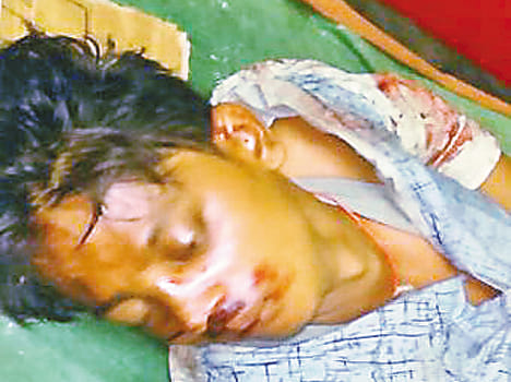 The procession entered the car dumper, a death