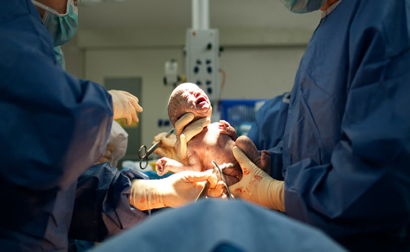 Mother filmed her entire caesarean on her iPhone