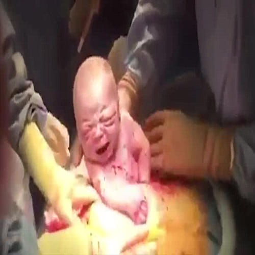 Mother filmed her entire caesarean on her iPhone