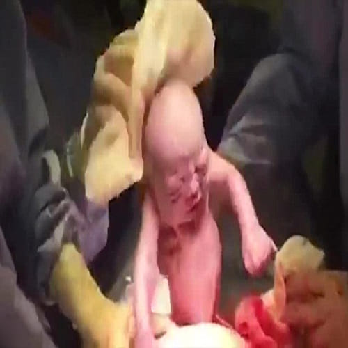 Mother filmed her entire caesarean on her iPhone