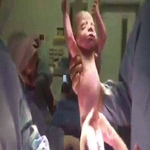 Mother filmed her entire caesarean on her iPhone