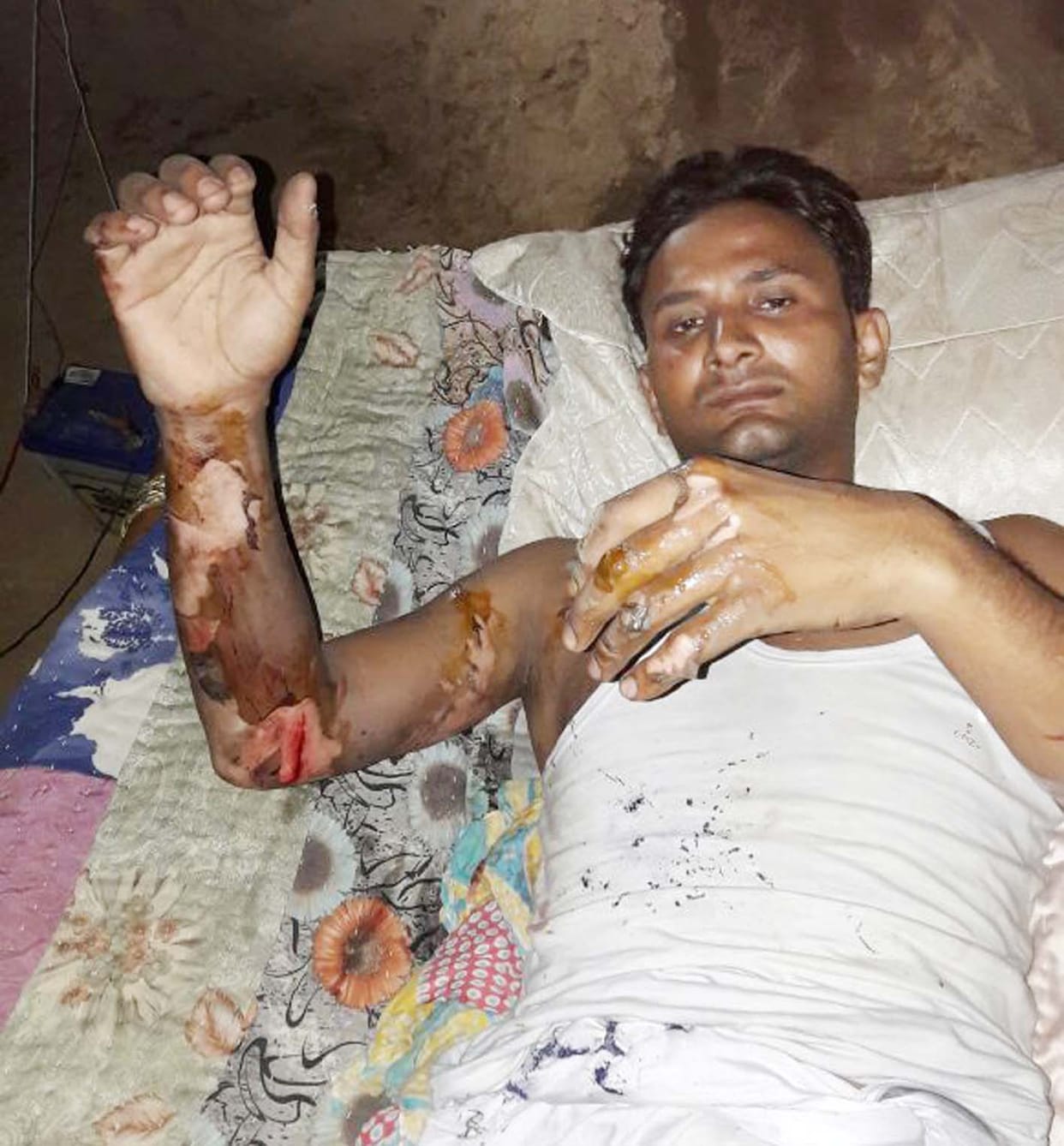 The current student's death, several scorched