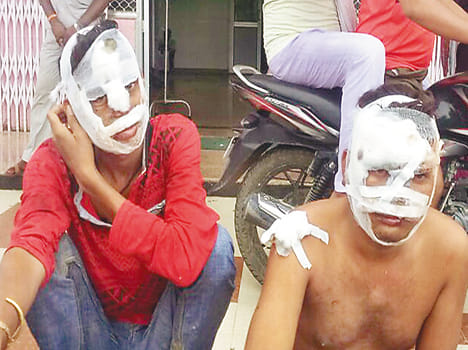 The injured, including two young men fell into the pit bike