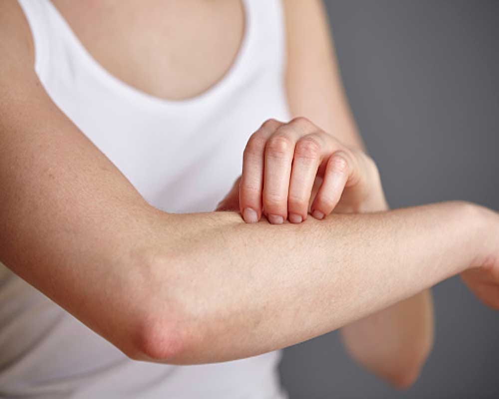 Reasons mosquitoes bite some people more often than other people