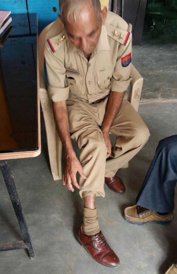 Inspector of monkey attacks wounded