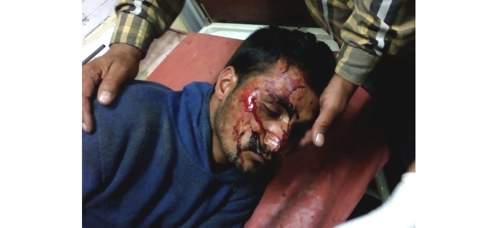 10 injured as attack on employees bus at kinnaur shongtong project.