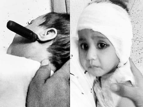 While playing in the baby's ears pierced through head being sunk screwdriver