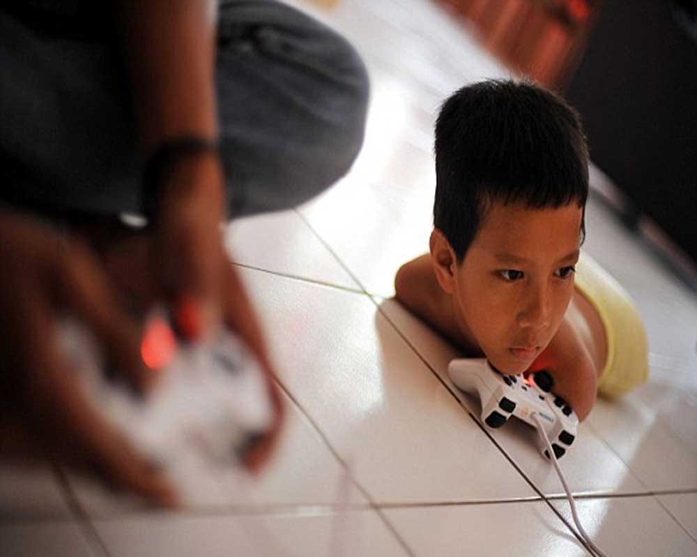 Boy without arms and legs learned to play computer games with his CHIN