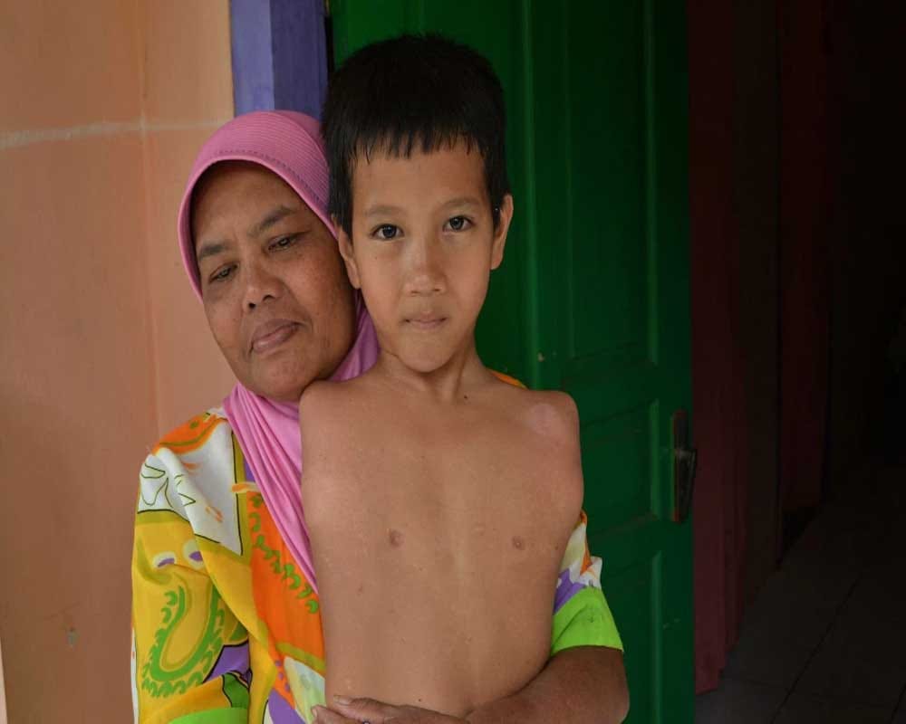 Boy without arms and legs learned to play computer games with his CHIN