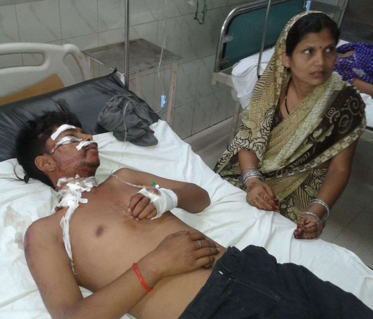 Three people injured in road accidents