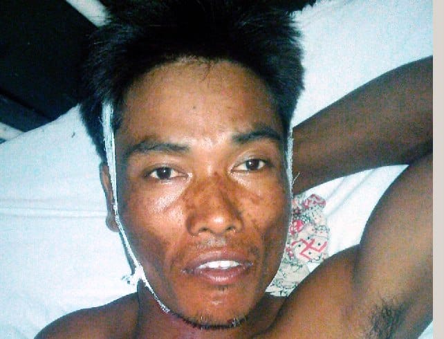 Tiger attack on the Tharu youths, injured