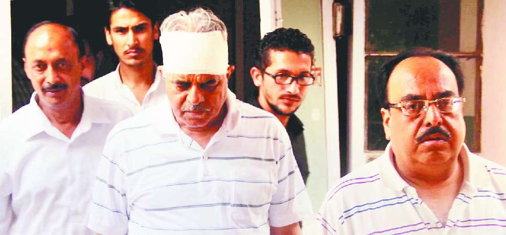 BJP MP virender kashyap injured after he fell in Temple
