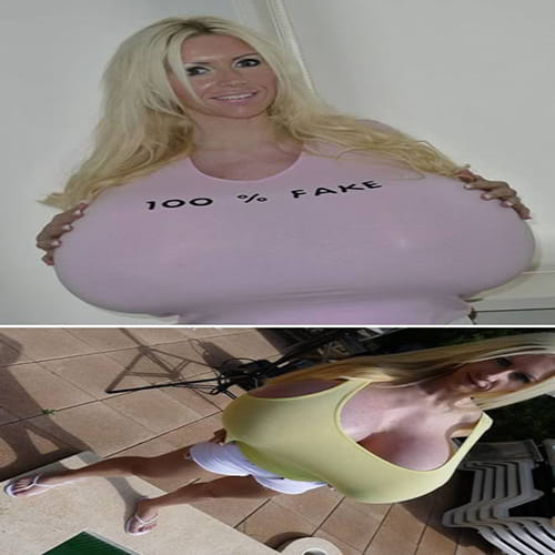 Disturbing Body Parts after Plastic Surgery