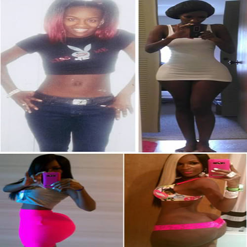 Disturbing Body Parts after Plastic Surgery