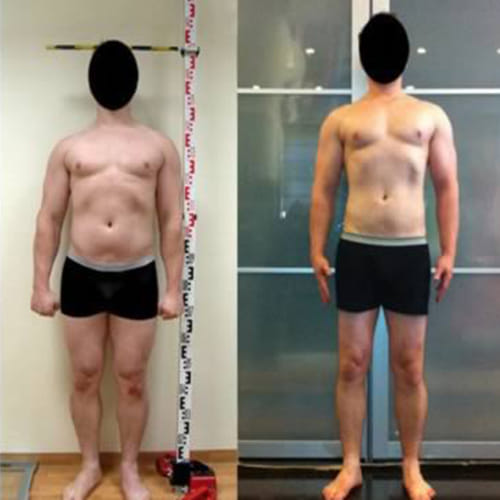 Disturbing Body Parts after Plastic Surgery