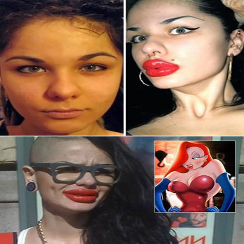 Disturbing Body Parts after Plastic Surgery