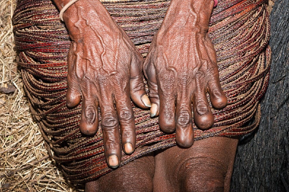 wife fingers cut down after husband death