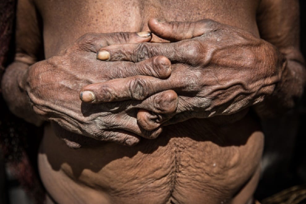 wife fingers cut down after husband death