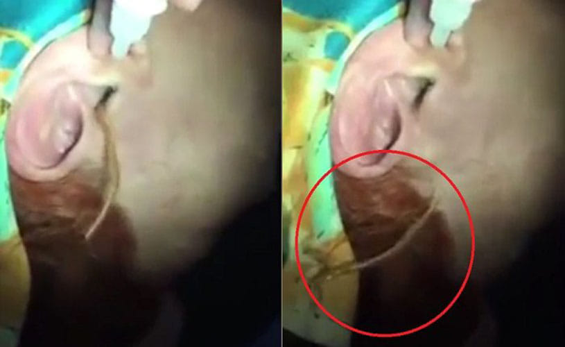 huge centipede removed from girls year