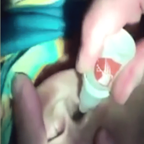 huge centipede removed from girls year