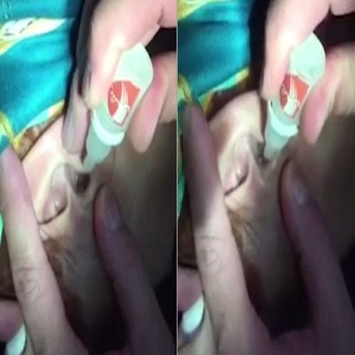 huge centipede removed from girls year